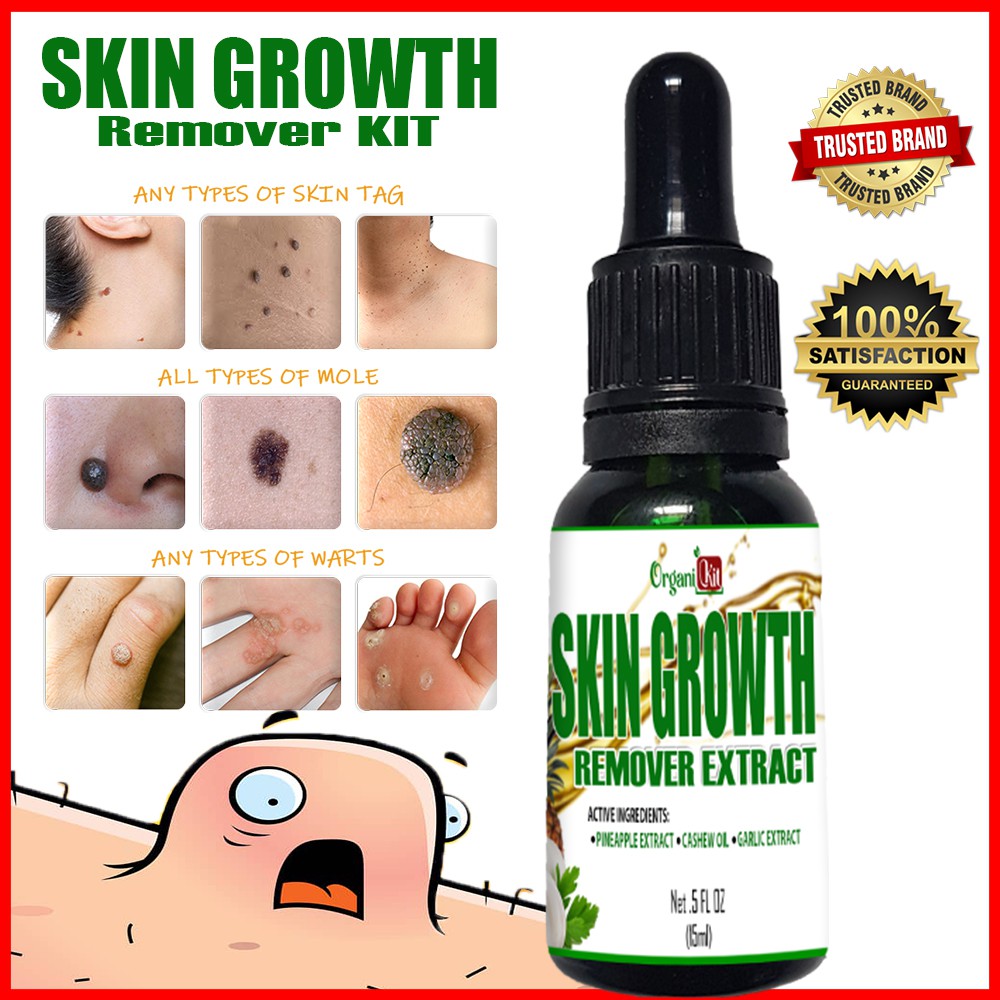 \u26a1Organikit skin growth remover oil\u26a1 Kulugo remover \/ Warts removal ...