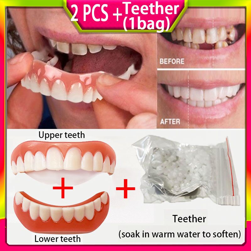 Upper and lower teeth simulation braces Whitening braces 2nd generation