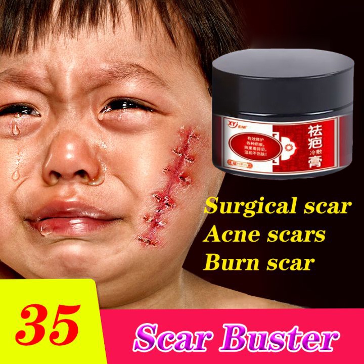 Scar Remover Cream 30g Skin Repair Cream Acne Scar Remove Spots Acne
