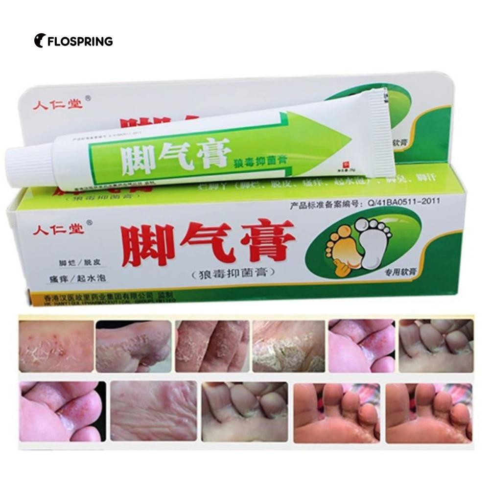【COD】Useful 25g Foot Care Cream Athlete's Itch Blisters Peeling