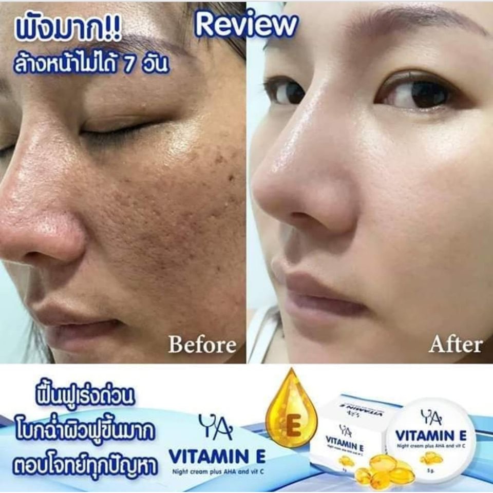 before and after vitamin e cream