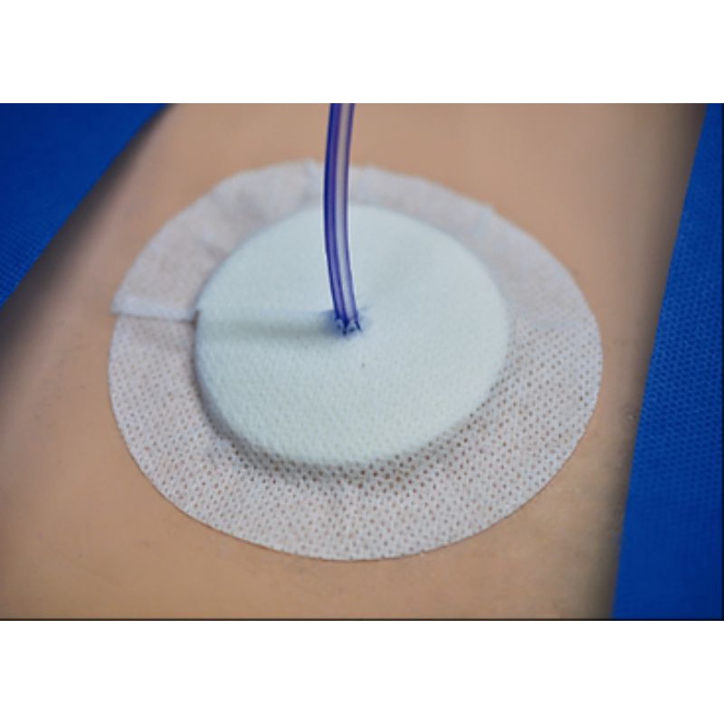 Cath Dressing (Drainage Tube Dressing) Shopee Philippines
