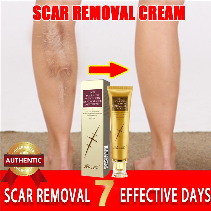 scar stretchmarks peklat acne remover original stretch mark removal old