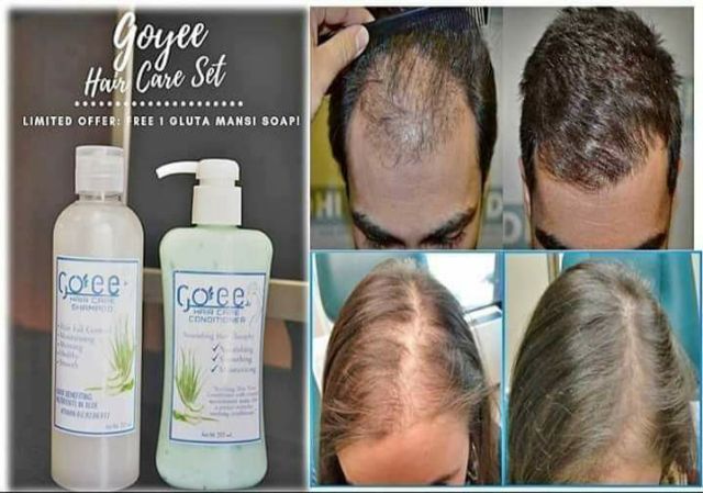 Goyee Shampoo Only 1 Shopee Philippines