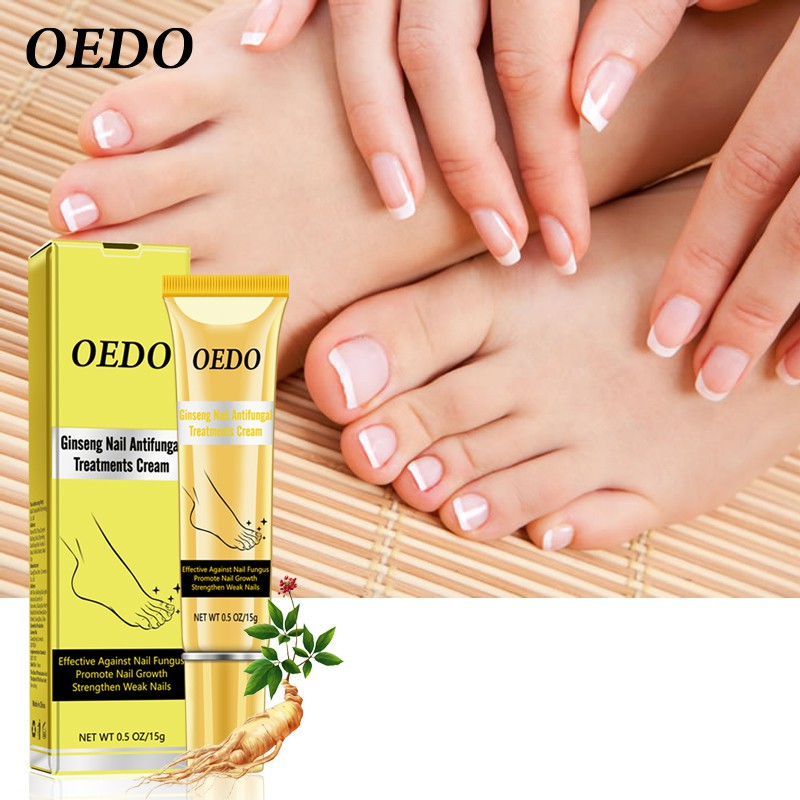 OEDO Ginseng Nail Antifungal Treatments Cream Removal Gel Anti