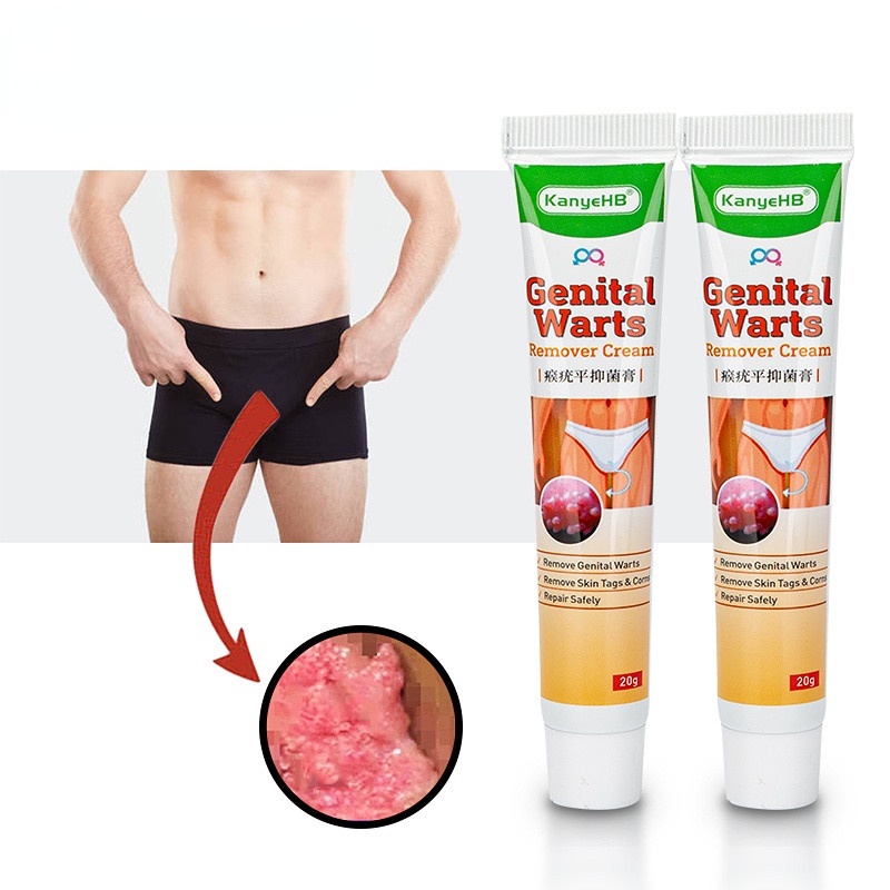 Antibacterial Treatment Cream Ointment Warts Remover Sexual Herpes