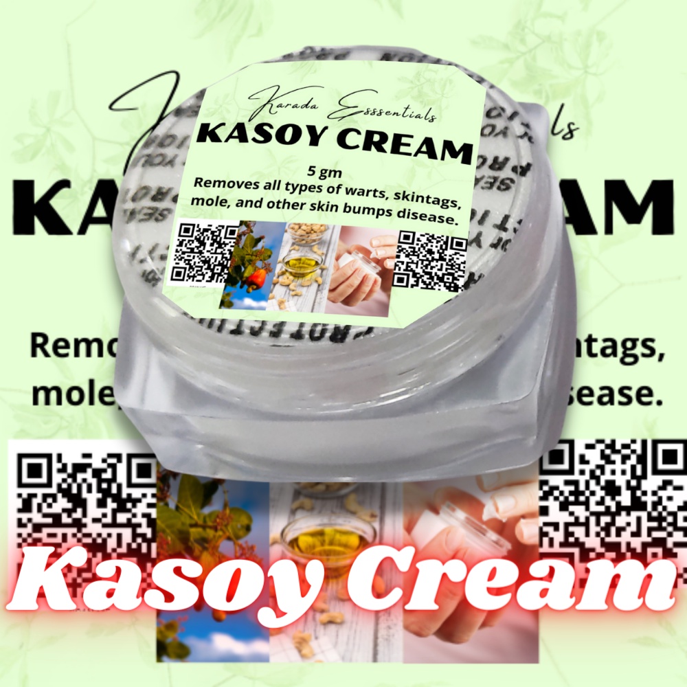 kasoy cream warts removal