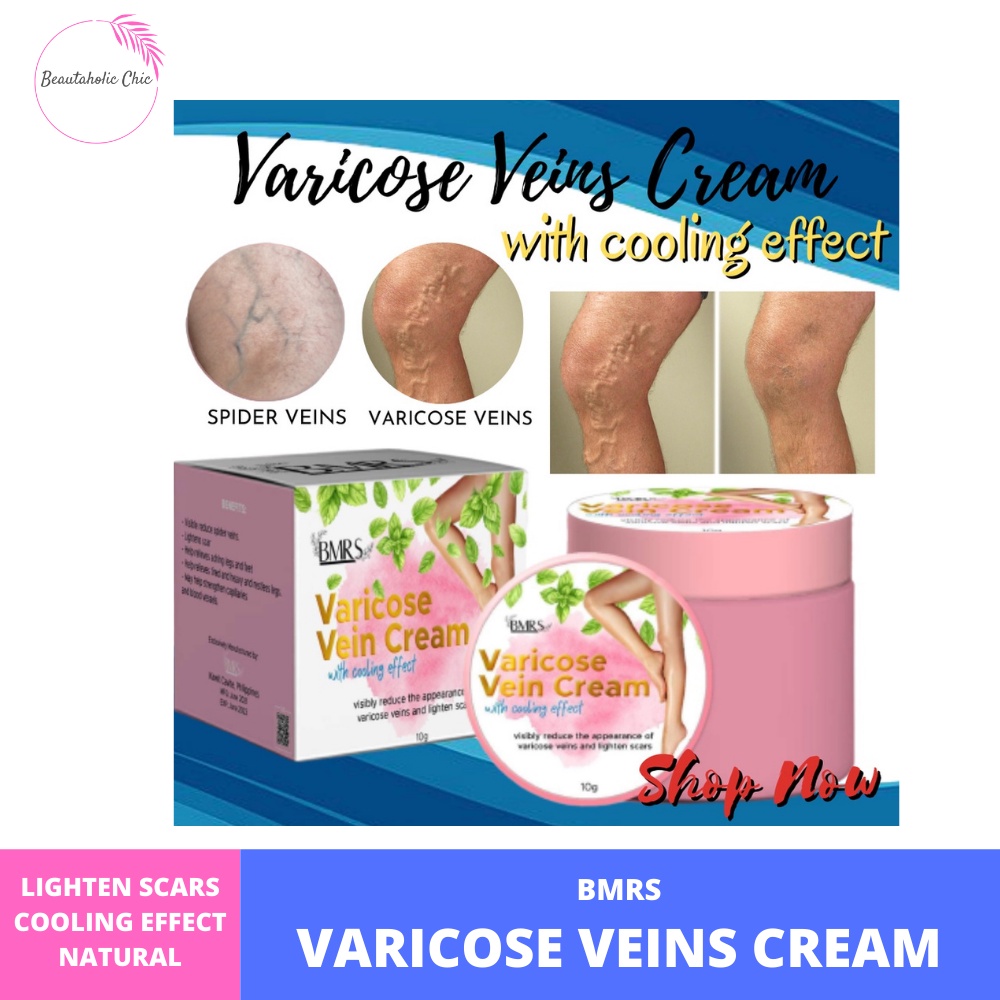 BEAUTAHOLIC BMRS Varicose Vein Cream Original | Varicose Vein Remover ...