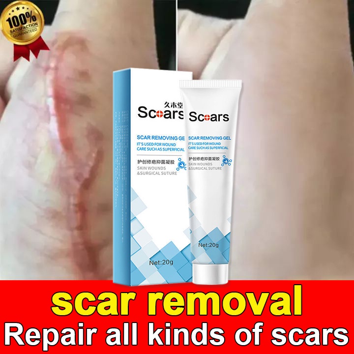 Jiumutang Scar Removal Cream Cure scar repair gel light scar cream