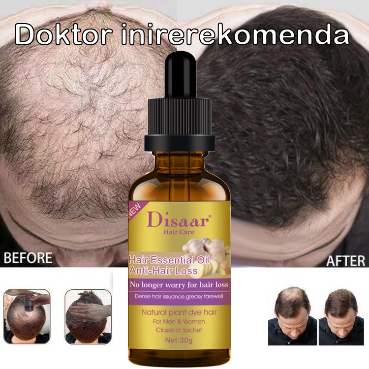 Hair Growth Serum Oil Anti Hair Loss Treatment Prevent Baldness Hair
