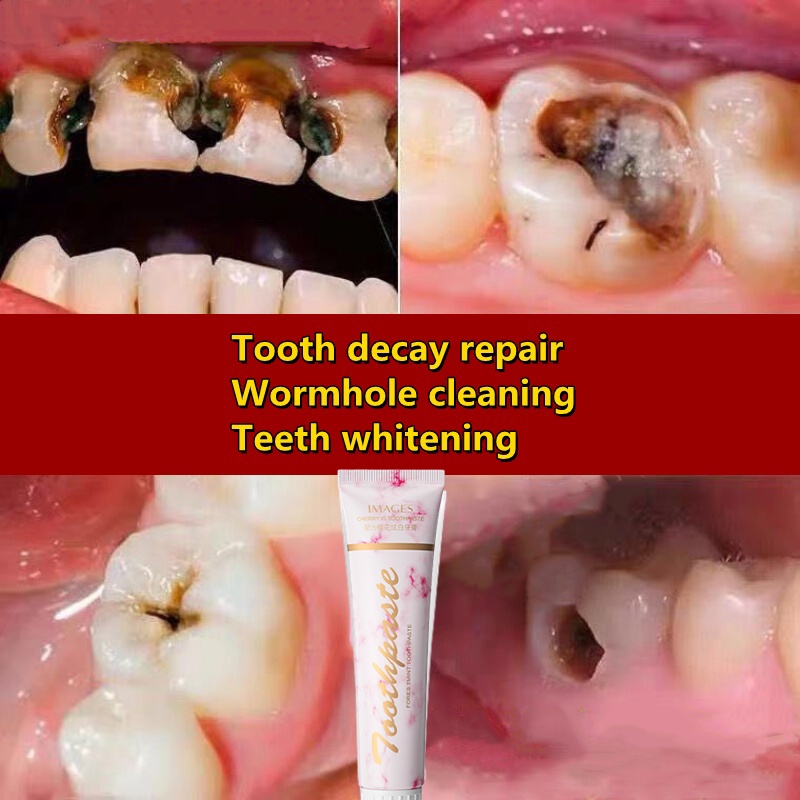 Teeth Whitening Toothpaste Removal of Calculus Tobacco Tooth Bad Breath