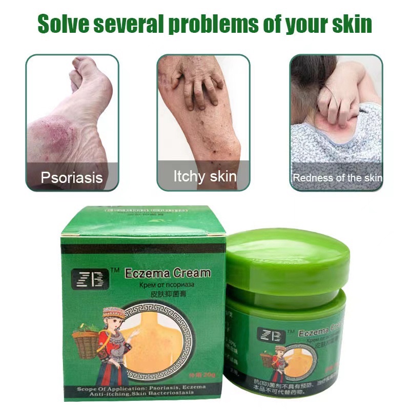 Zb 20g Antibacterial Skin Psoriasis Cream Dermatitis Eczematoid Eczema Ointment Psoriasis Skin 0342