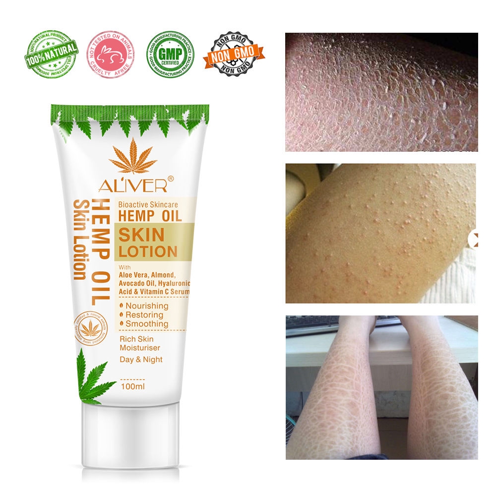 oil skin lotion