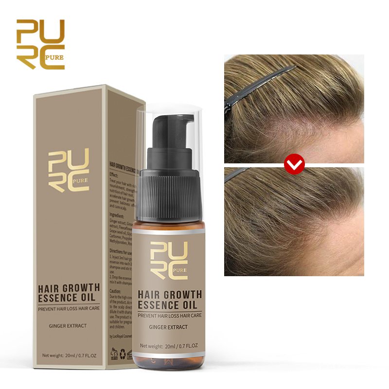 PURC Ginger Hair Growth Oil Prevent Hair Loss Promote Hair Follicle ...