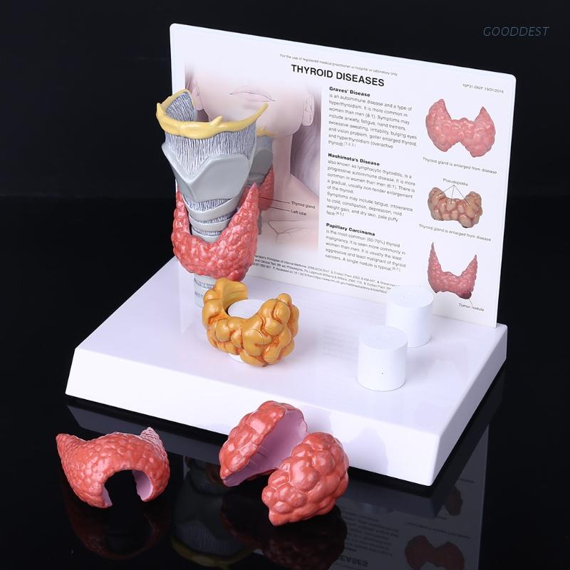KH66ZKY Thyroid Anatomy Model - Thyroid Nodule Model - For Science Classroom Study Display Thyroiditis Mastoid Cancer Teaching Medical Model