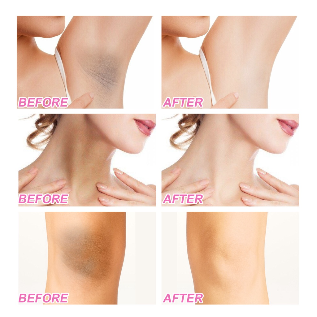 Underarm Whitening Cream Privates Whitening Care Brightening Skin Tone for Neck Back Legs Elbows