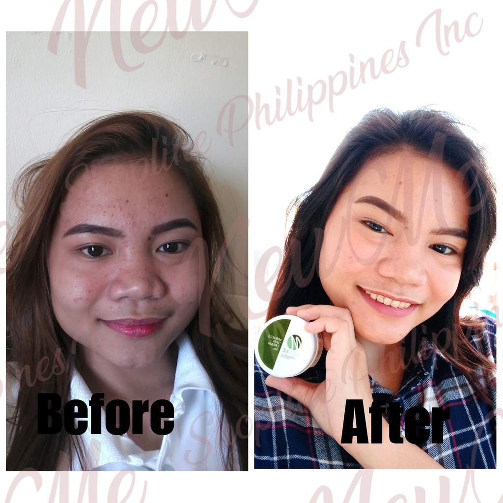 new me miracle cream benefits