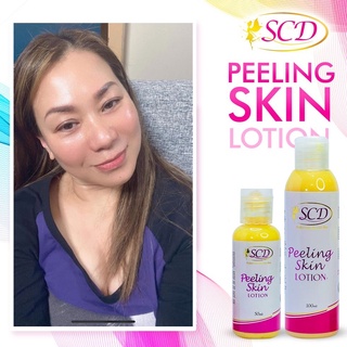 SCD Peeling Skin Lotion 100ml (FDA and HALAL APPROVED) | Shopee Philippines