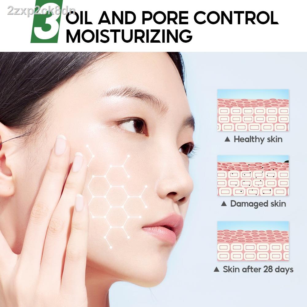 【Factory price】▧∏℡◆VIBRANT GLAMOUR Herbal Acne Treatment Toner Deep Repair Soothing Skin Reduce Pim