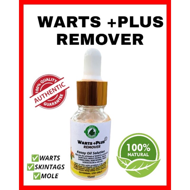 Warts Remover Plus Authentic Kasoy Oil Solution for Wart Mole Skintags ...