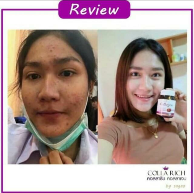 Colla Rich Collagen Tripeptide Zinc Shopee Philippines