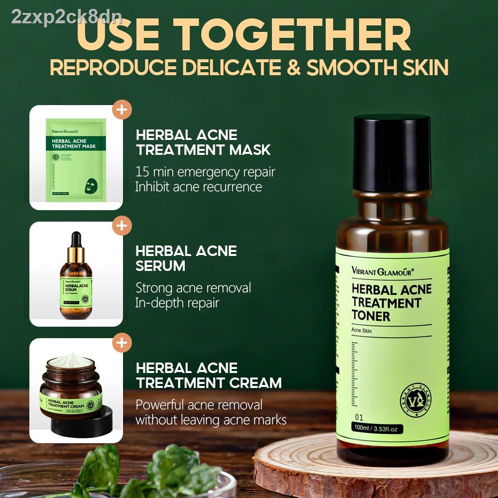 【Factory price】▧∏℡◆VIBRANT GLAMOUR Herbal Acne Treatment Toner Deep Repair Soothing Skin Reduce Pim