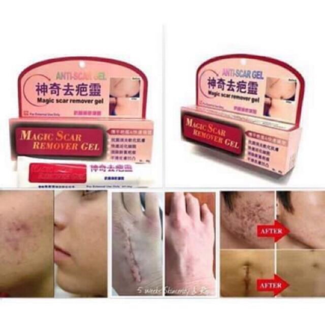 ⛔️ Magic Scar ⛔️ Removal Gel keloid Stretchmarks pimple mark peklat