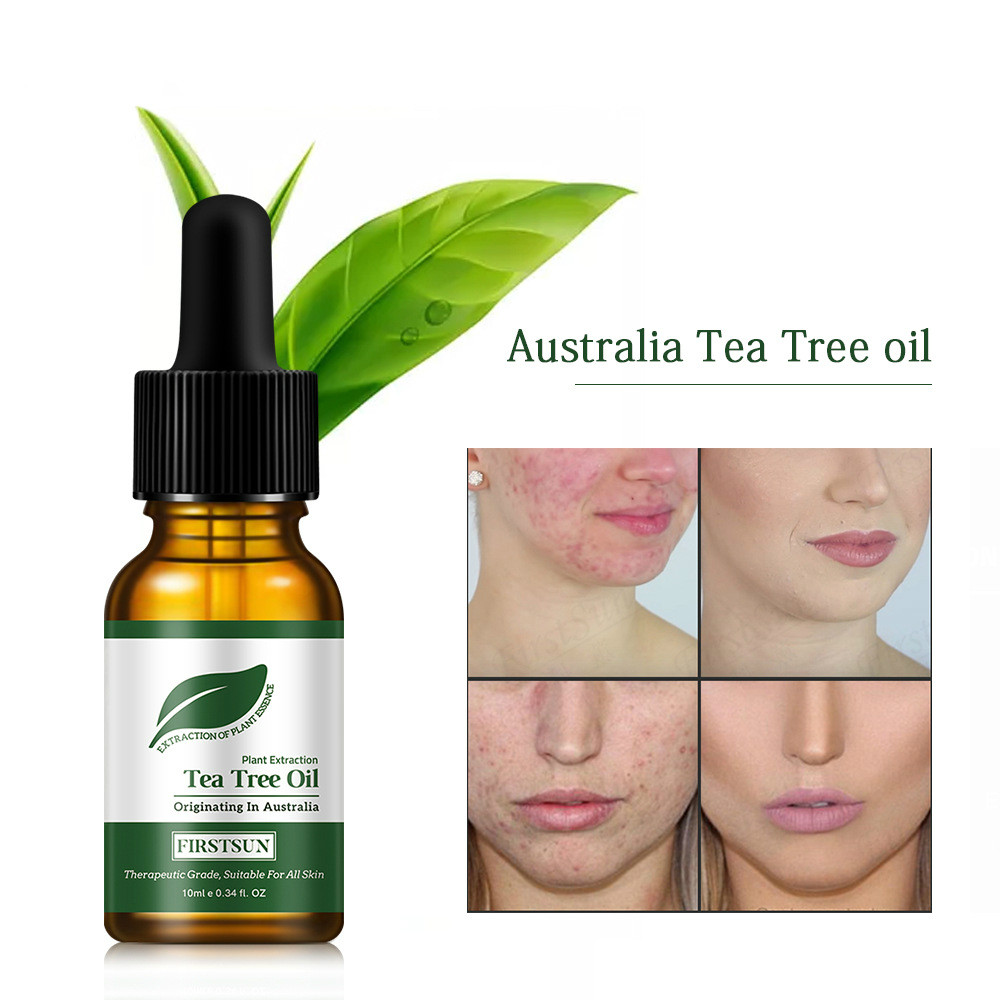 tea tree oil good for acne scars