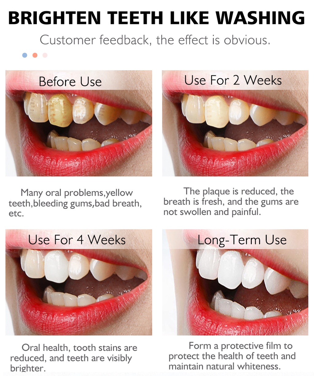 RtopR Teeth Cleansing Whitening Mousse Removes Stains Oral Hygiene ...