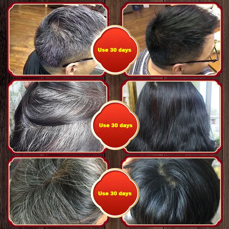 Black Hair Shampoo Oil Control hair Care Chinese herbal Anti-Hair Loss Smooth Hair