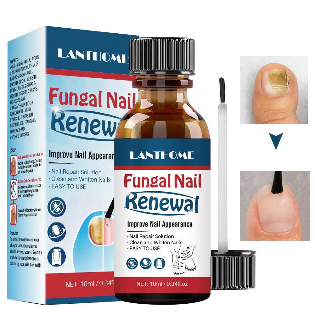 LANTHOME 10ml Fungal Nail Repair Nourish Fungal Nail Treatment To