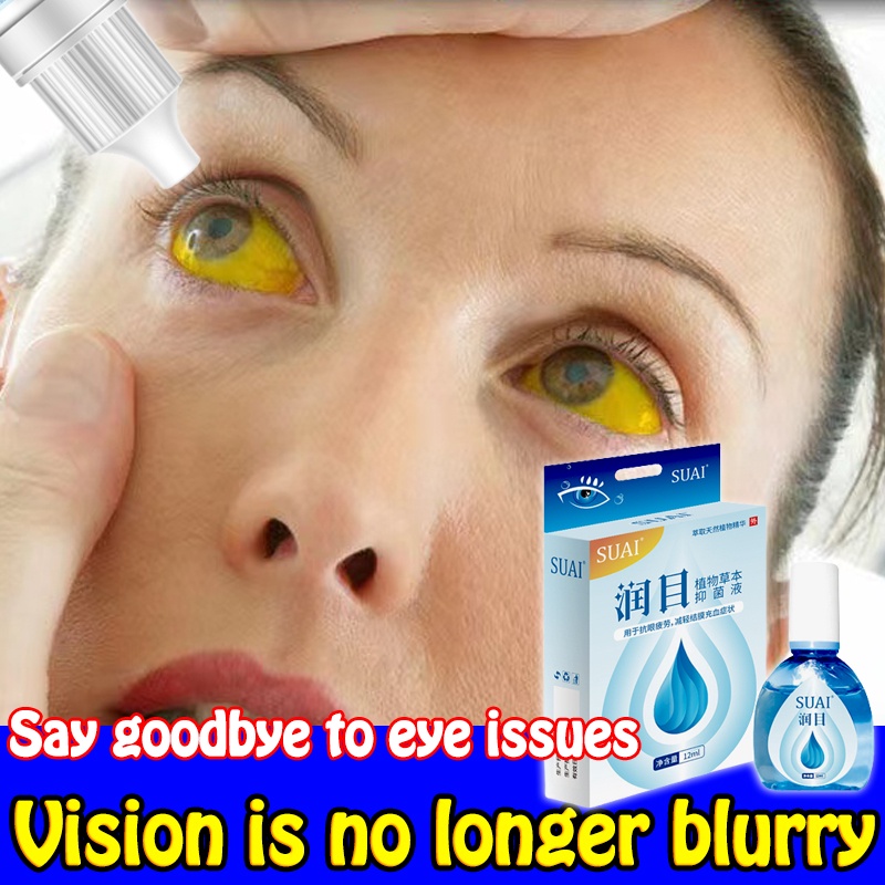 Eye Drop/itchy PugitaDry EyesSore EyesVitamin