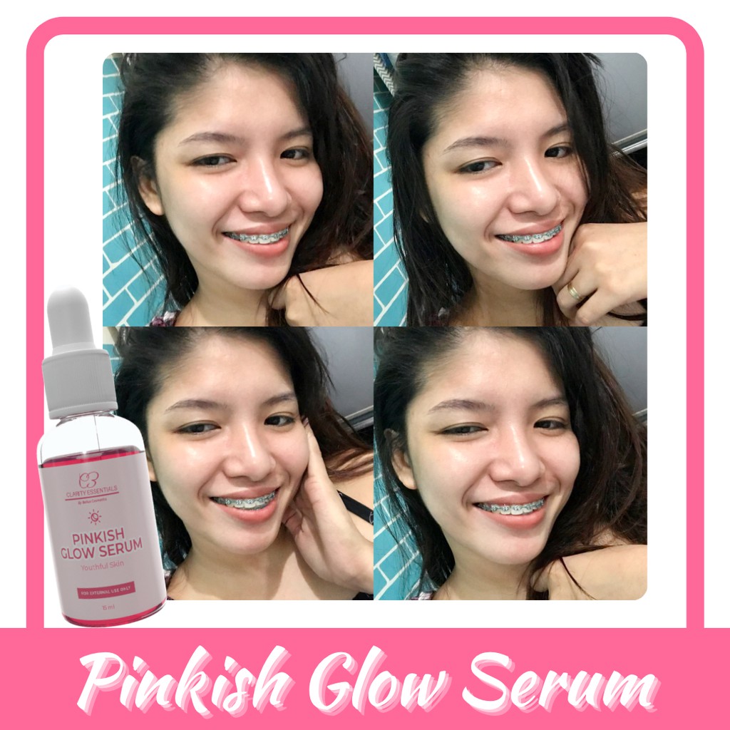 Pinkish Glow Serum - Glass Skin Serum - Korean skin | Shopee Philippines