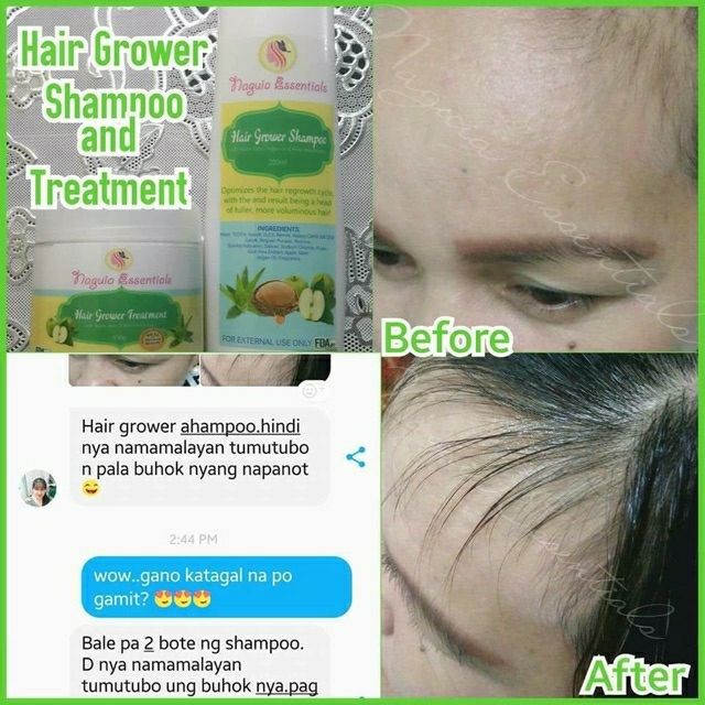 Naguia Hair Grower Shampoo Treatment Shopee Philippines