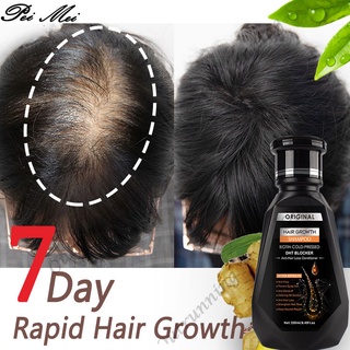 PEIMEI Ginger Shampoo Hair Growth Shampoo Anti-Hair Loss Shampoo Natural Hair Growth 250ml 100%