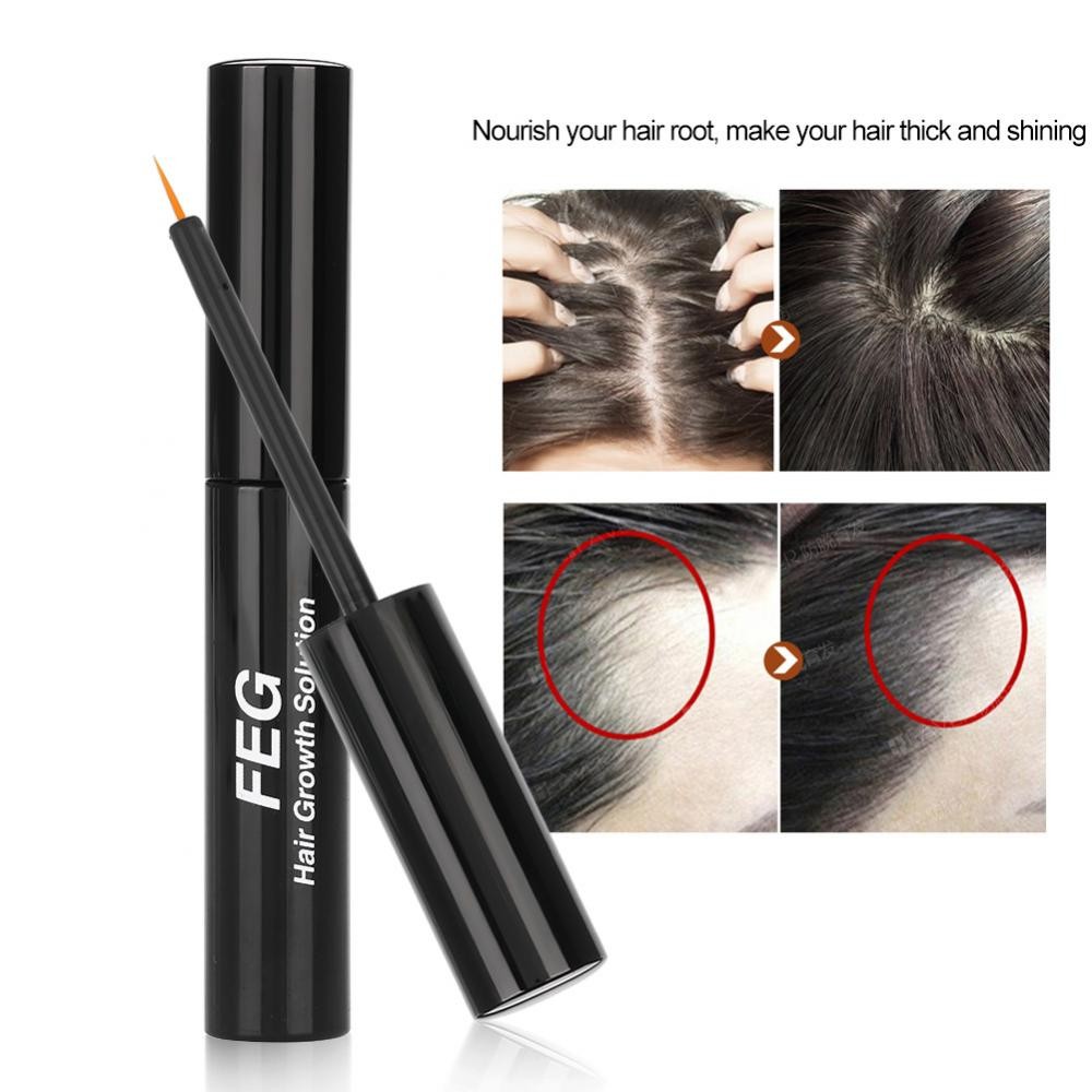 Natural Hair Growth Essence Scalp Health Hair Loss Treatment
