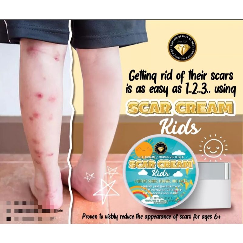 LEGIT AND SUPER EFFECTIVE scar removal cream for kids/anti scar/ PEKLAT REMOVER Shopee Philippines