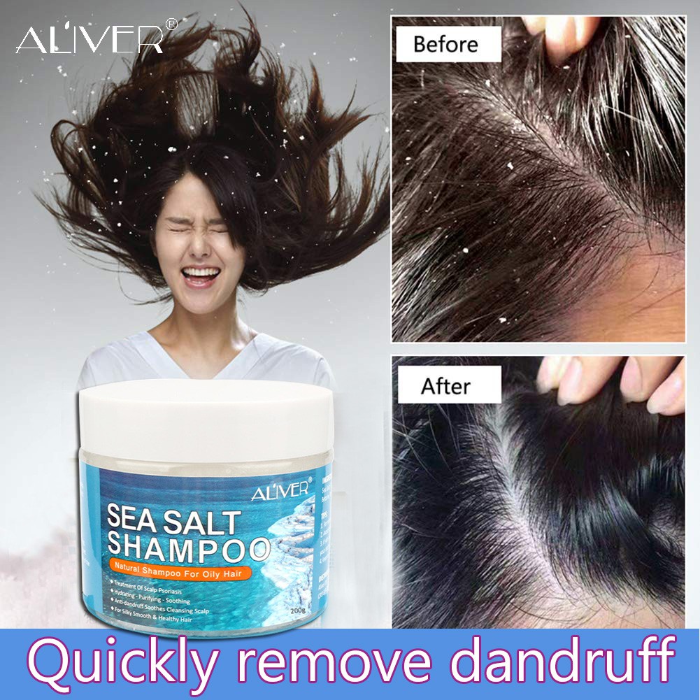 ALIVER Sea Salt Shampoo Anti Dandruff Shampoo Hair Treatment Shampoo remove  Scalp Itching Psoriasis | Shopee Philippines