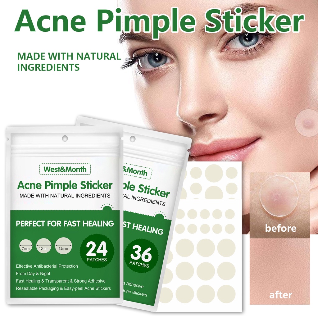 Acne Pimple Patch Hydrocolloid Acne Spot Treatment  Invisible Pimple Patch for Healing Acne Dot