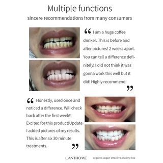 Teeth Cleaner Mousse Remove Yellow Stains Plaque Teeth Bright Whitening Fresh Breath Tooth Oral Care #7