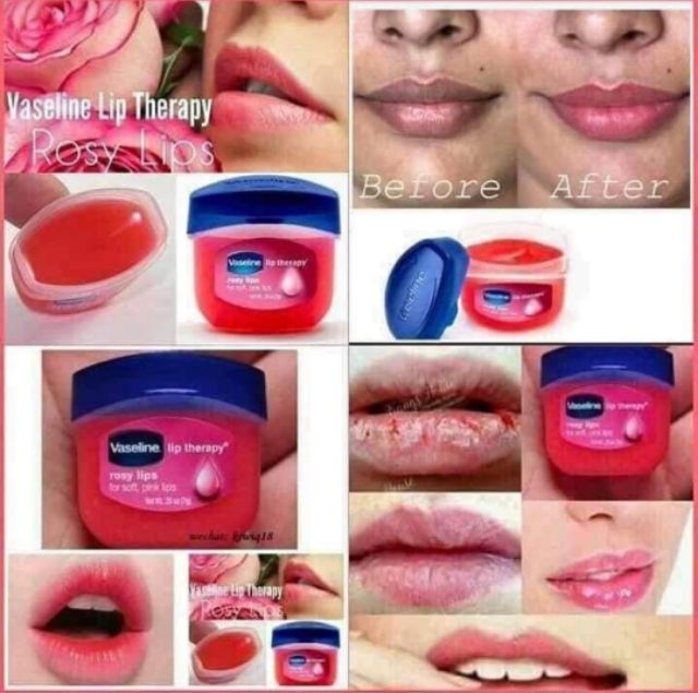 Vaseline Lip Therapy Rosy Lips Benefits