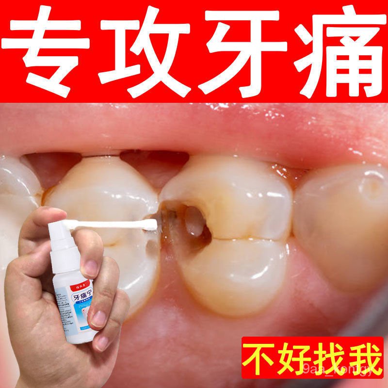 Fast Stop Toothache Toothache Can Stop Worms Tooth Decay Tooth Cavity