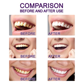 Teeth Whitening Pen Repair Bright White Anti-Sensitive Remove Smoke Stains Plaque Tooth Whitening Pen #5
