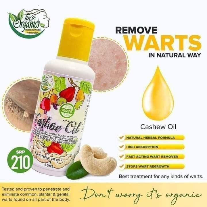 CASHEW OIL (ANTI WART AND ANTI SKIN AND FUNGI) Shopee Philippines