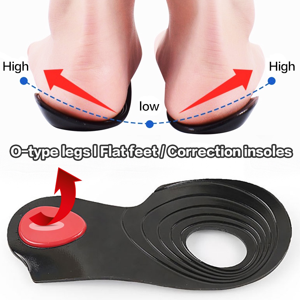 1 pair Flat Foot Corrector Gel Insole Cure Flat Feet O/X Leg Arch ...