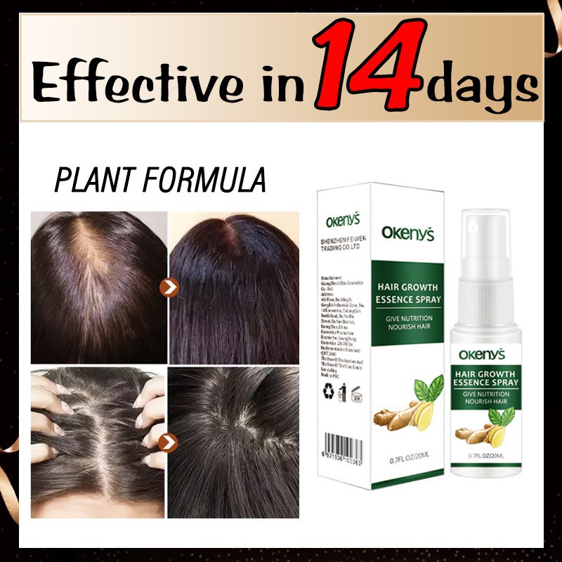Shopee TOP10∏Hair Grower spray hair growth essense 100% authentic Hair Loss  Treatment Ginger for men | Shopee Philippines