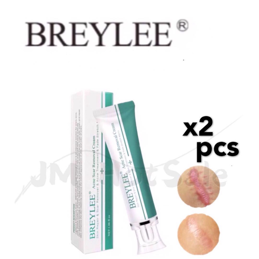 JM (2pcs) BREYLEE Acne Scar Removal Cream 30g Face Cream Skin Repair