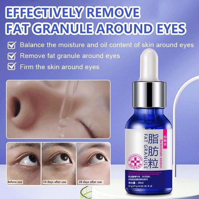 YOY Anticellulite eye cream essence Fat Granule Removal Essence Fat