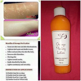 mve peeling lotion