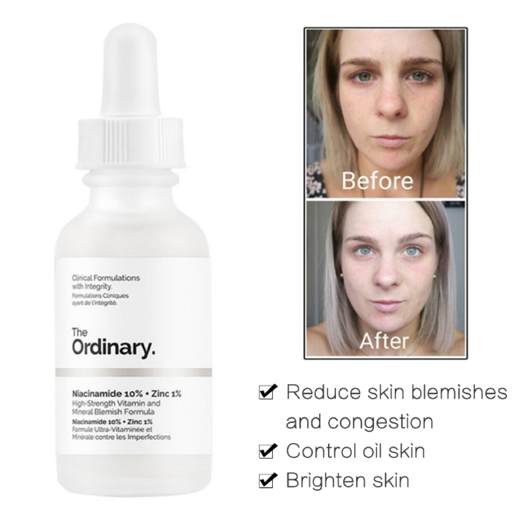 the ordinary serum niacinamide 10